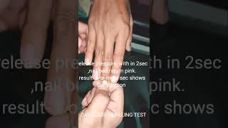 CAPILLARY REFILLING TEST FOR CHECK HYDRATION STATUS OF PATIENT...