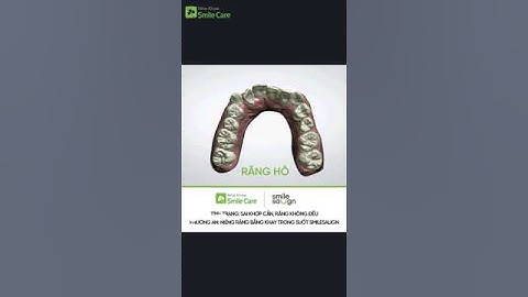 Phác đồ niềng răng - Smilesalign Việt Nam