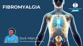 Fibromyalgia Diagnosis Webinar