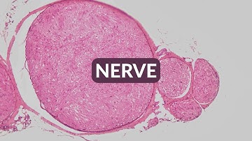 Histology Made Easy: CROSS SECTION OF NERVE at 40x,100x, 200x and 400x magnification