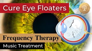 Eye Floaters Music Therapy ๏ All Rife Frequencies Bioresonance Treatment ๏ Heal Vitreous Opacity