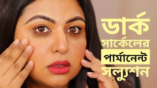 ডার্ক সার্কেল দূর করার উপায় | Eye Cream to Reduce Dark Circles || Ananya Artistry