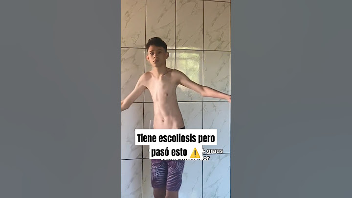 Tenía escoliosis pero hizo esto #gym #escoliosis #fitness #bodybuilding