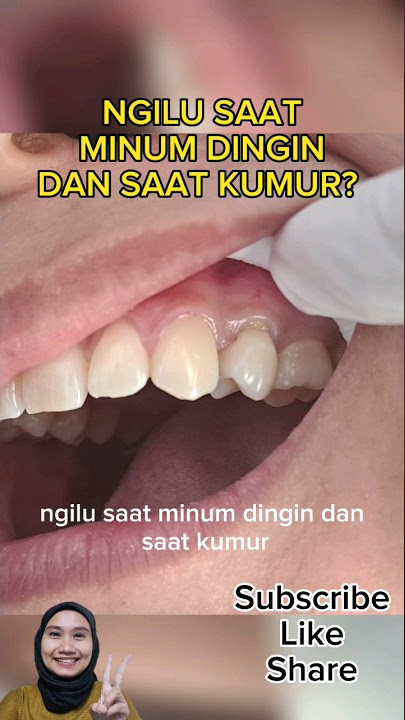 GIGI NGILU SAAT MINUM DINGIN DAN SAAT KUMUR | drg. Shanti Yuniwardani