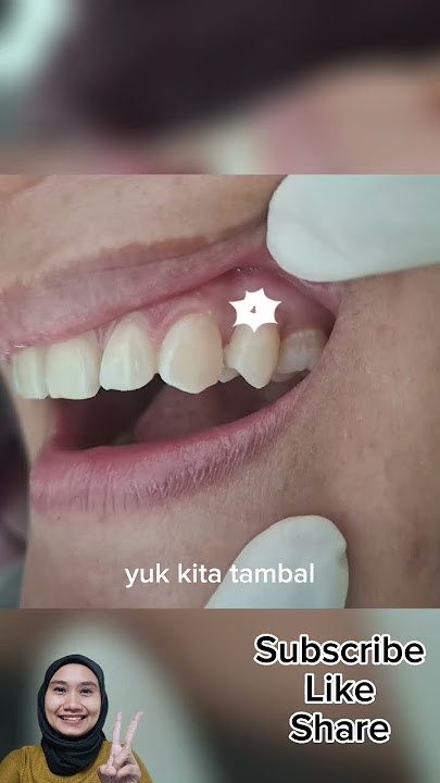 GIGI NGILU SAAT MINUM DINGIN DAN SAAT KUMUR | drg. Shanti Yuniwardani