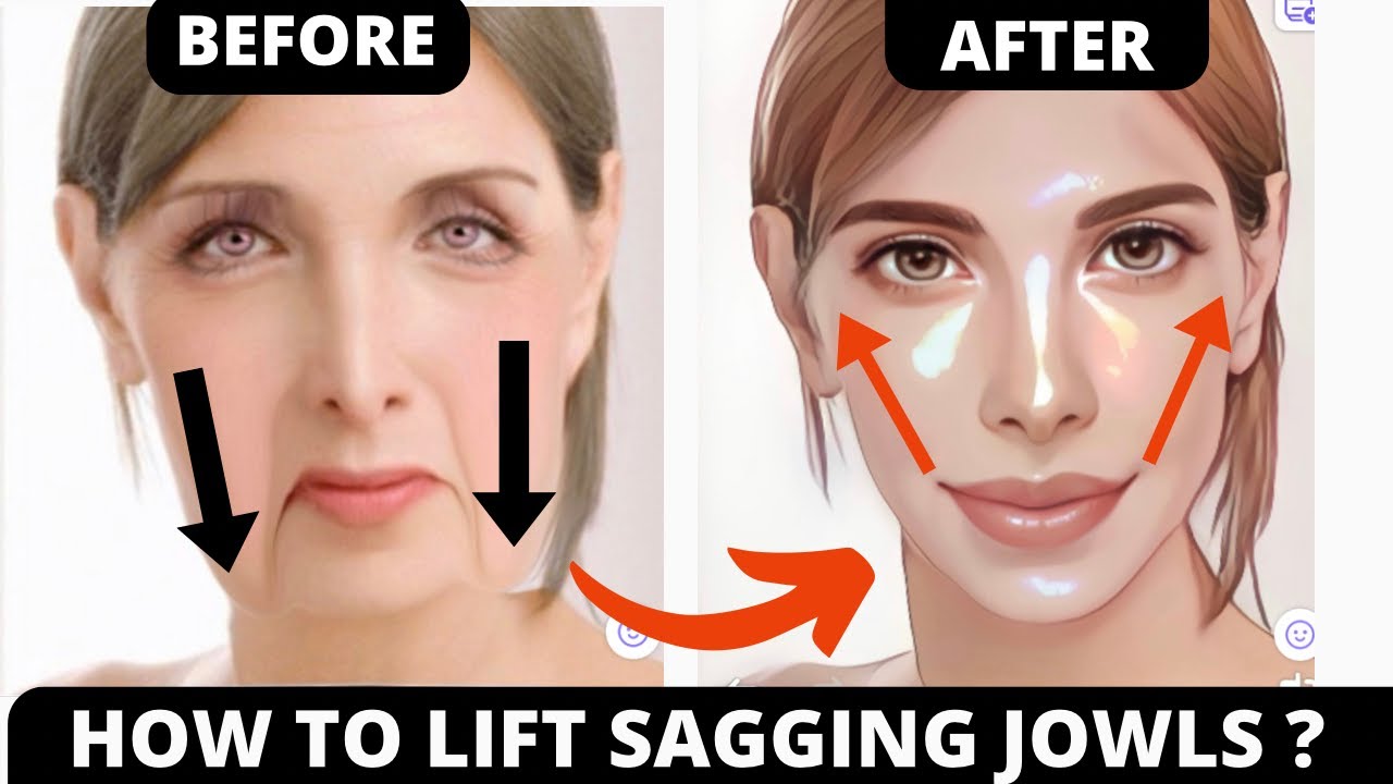 No Surgery! 22-Minute Face Yoga to Lift Sagging Jowls, Laugh lines & Smooth Wrinkles!