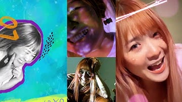 OFFICIAL MV// Lena - Niềng răng