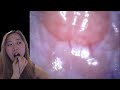 What your mouth looks like using an endoscope