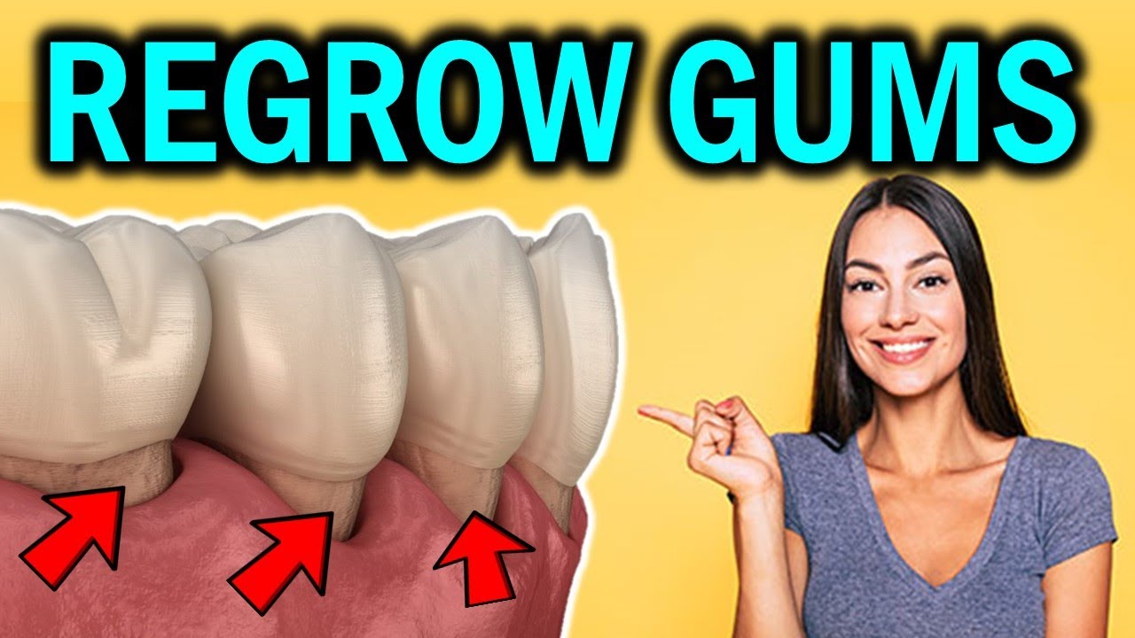 ⁣How to Regrow Receding Gums Naturally (Reverse Gum Recession without Surgery)