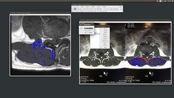 用imagej的ROI manager選取不同顏色的組織(2)