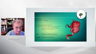 Deepening our understanding of aneurysms – experience with the Medtronic Pipeline Devices