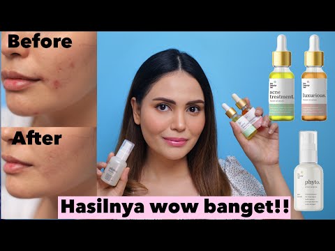 FULL REVIEW SEMUA PRODUK BIO BEAUTY LAB