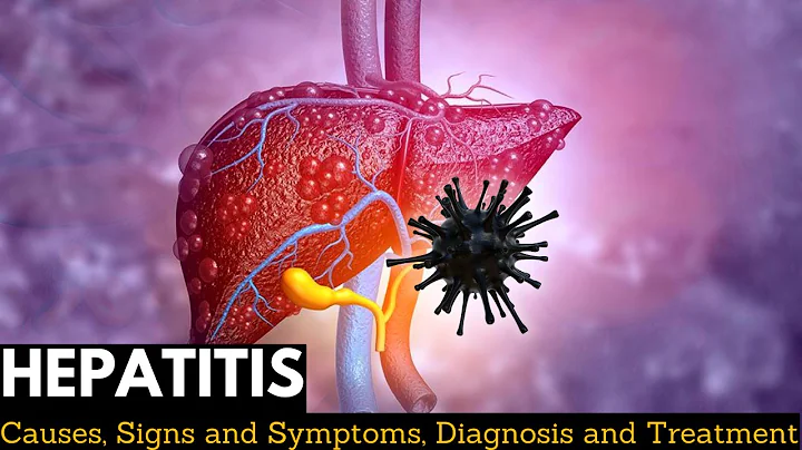 Hepatitis, Causes, Signs and Symptoms, Diagnosis and Treatment. - DayDayNews