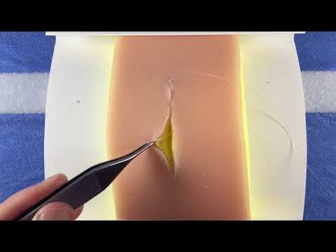 Vídeo: Com es cusen les sutures?