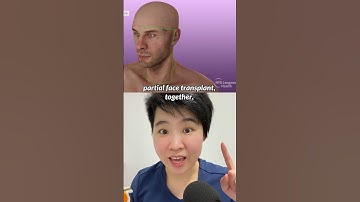 Huge respects! These guys made history! #eyetransplant #surgery #medicine