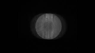 Single pass Ronchi-test of a deliberately poor figured 60mm diameter plano-convex lens.
