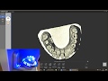 3d dental store  le support universel pour vos scans 3d dentaires