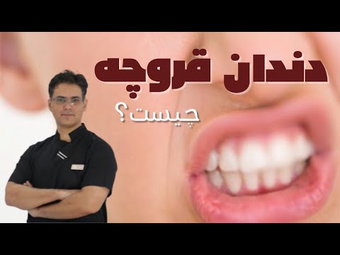 تصویری: در مورد دندان قروچه چه کسی را ببینیم؟