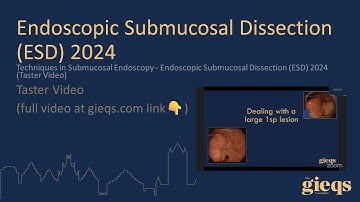 Techniques in Submucosal Endoscopy - Endoscopic Submucosal Dissection (ESD) 2024 (Taster Video)