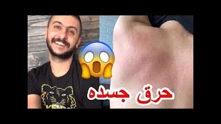 فهد العرادي - علاء  حرق جلد فردوس في لعبة بطل الماي