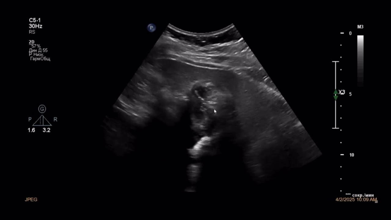 Ответ на задачу