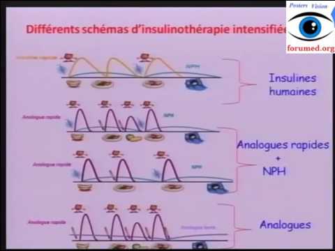 Vidéo: Plan D'insuline Basal-bolus Pour Le Diabète