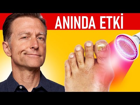 Gut Hastalığı (Yüksek