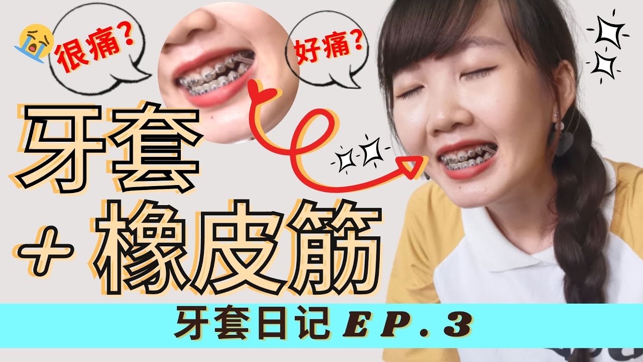 牙套中的橡皮筋让我痛不欲生啊~牙套牙齿必经疗程~ |牙套牙齿咬合~!! -EP.3 |【44_牙套日记】