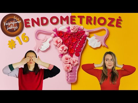 Endometriozė: kokia tai liga, kaip ji pasireiškia ir kaip su ja gyventi | Vaisingumo šaknys #16