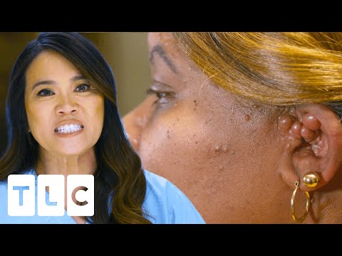 Download Dr. Lee Treats Sisters With Matching Bumps! I Dr. Pimple Popper