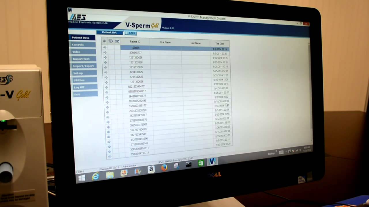 IMPORTING THE SQA-V ARCHIVE INTO V-SPERM | Sperm Quality Analyzer Training | www.mes-global.com