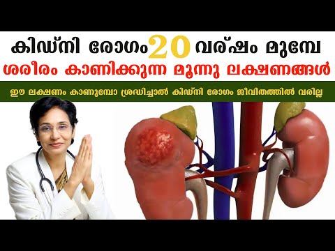 20 വര്ഷം മുമ്പേ ശരീരം കാണിക്കുന്ന ഈ ലക്ഷണം ശ്രദ്ധിച്ചാൽ ജീവിതത്തിൽ കിഡ്‌നി രോഗം വരില്ല /Kidney