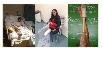 AMPUTATION/ RECOVERY & LEARNING TO WALK AGAIN...
