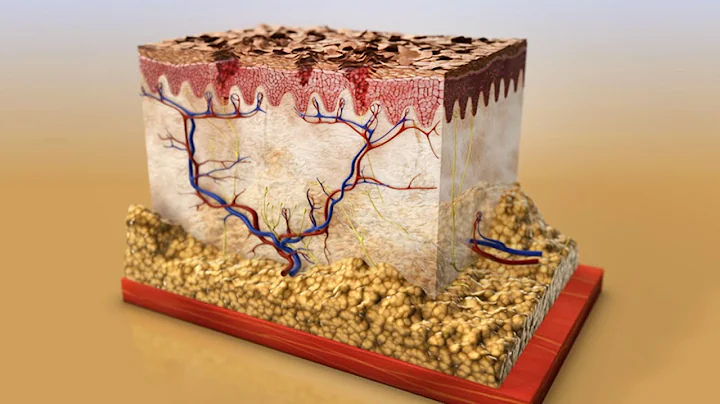 Atopic Eczema and Dermatitis