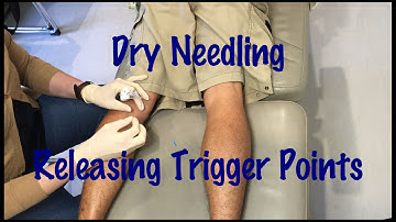 Dry Needling