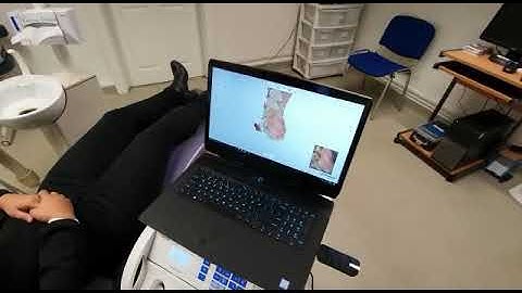 Invisalign 3D scanning with Trios