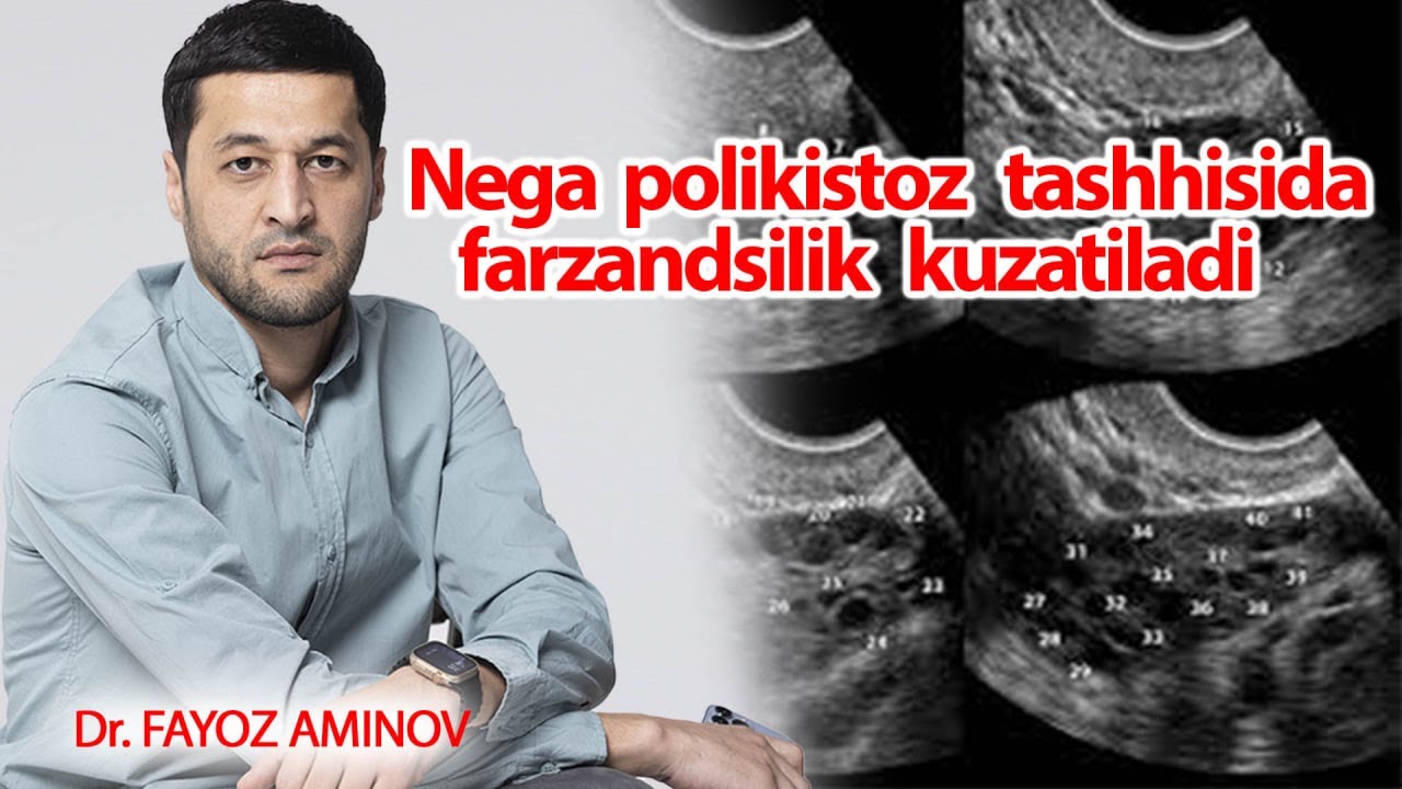 Nega polikistoz tashhisi farzandsizlikni sababi | Dr.Fayoz Aminov