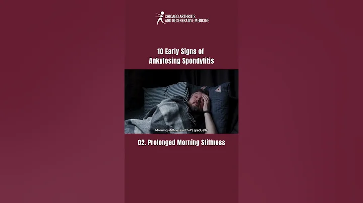 Prolonged morning stiffness | 10 Early Signs of Ankylosing Spondylitis You Shouldn’t Ignore!