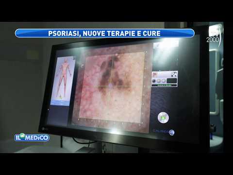 Il mio Medico (TV2000) - Psoriasis, causes and new treatments