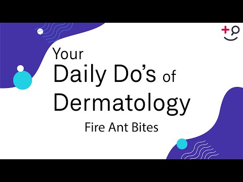 Fire Ant Bites - Daily Do&rsquo;s of Dermatology