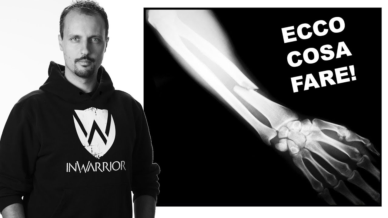 Cosa fare in caso di frattura (rottura di un osso) - Primo Soccorso e Difesa Personale