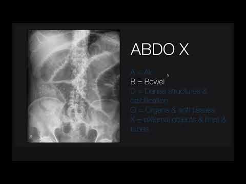Abdominal x-rays