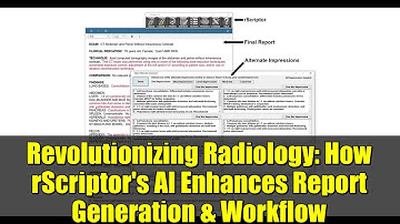 Revolutionizing Radiology: How rScriptor