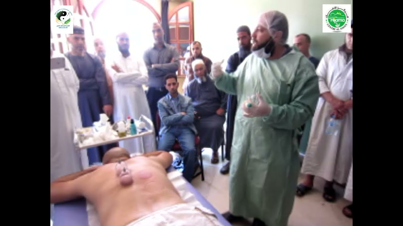 الجزء الأول لتعلم الحجامة عن بعد طريقة تعقيم اليدين ومباشرة المريض وأنواع الحجامة الجافة .