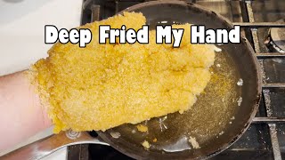 Download Lagu Deep Frying My Own Hand MP3