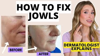 How to Fix Jowls: Dermatologist Explains How to Prevent & Get Rid of Jowls | Dr. Sam Ellis
