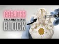 GREATER PALATINE NERVE BLOCK | OnlineExodontia.com