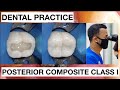 Dental practice class i composite restoration  general dentist griya rr