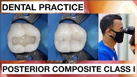 Dental Practice Class I Composite Restoration | General Dentist Griya RR