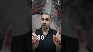 A Simplified Guide for Surgery: How to Tell Guarding from Rigidity and Resolve Perpetual Confusion